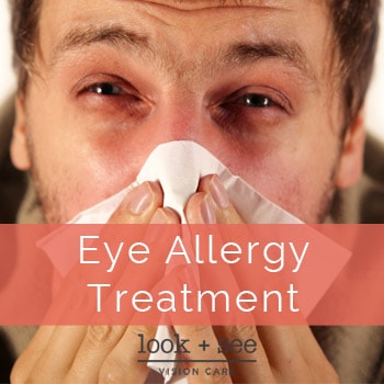 Eye Allergy Treatment